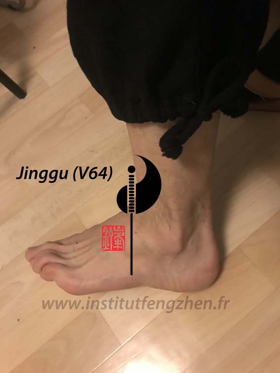 Jinggu (V64) – L’os proéminent